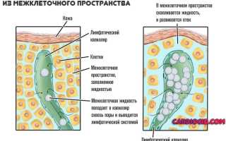 Код по мкб слоновость