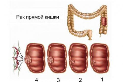 Стадии