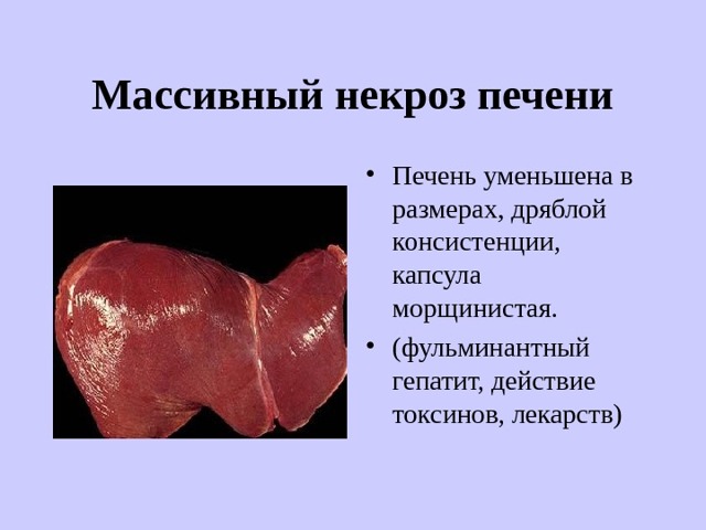 Некроз печени