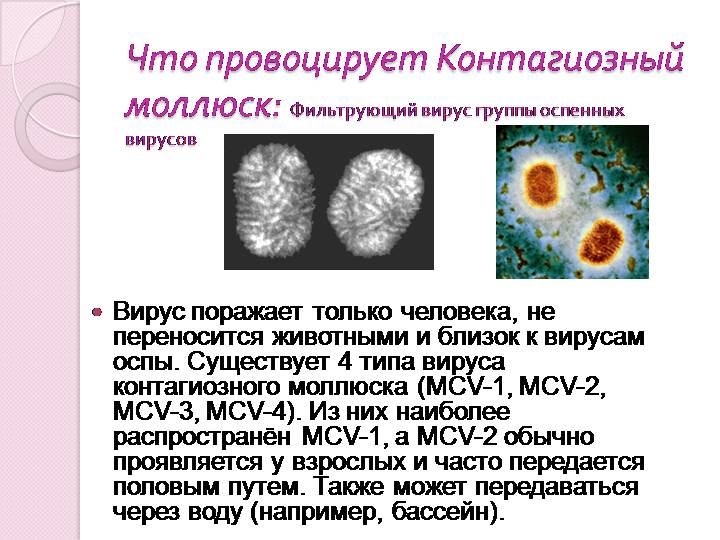Мкб 10 коды моллюска