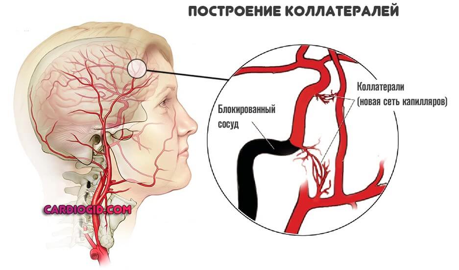 коллатерали