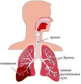 Код по мкб j18