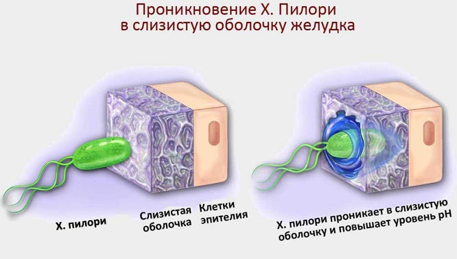 хеликобактер пилори