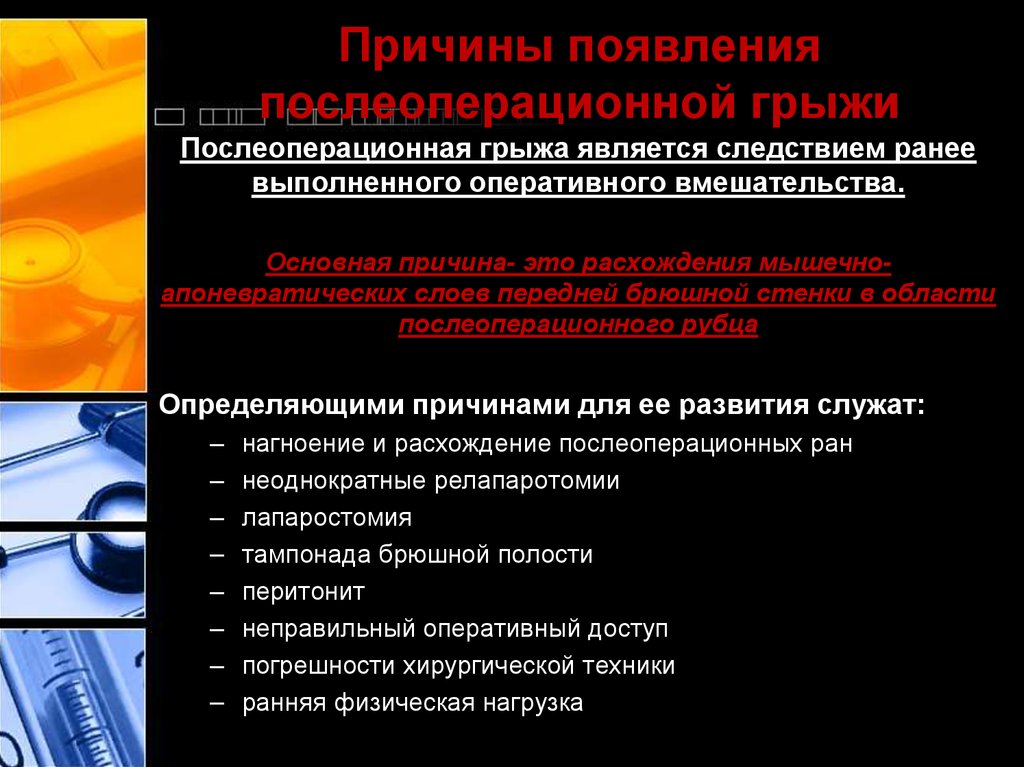 Послеоперационная вентральная грыжа код мкб