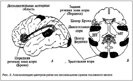 Рис. 2. Локализация центров речи на аксиальном срезе головного мозга Рис. 2. Локализация центров речи на аксиальном срезе головного мозга
