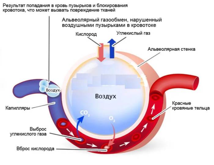 Ранение грудной клетки код мкб