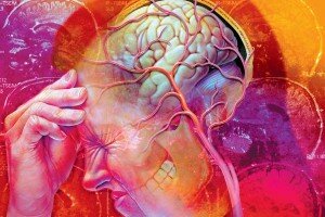 Головная боль Дифференциальная диагностика синдрома головная боль