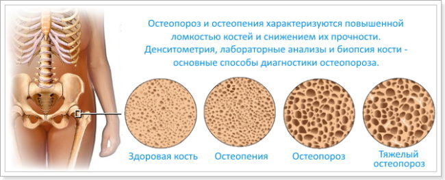 Развитие болезни