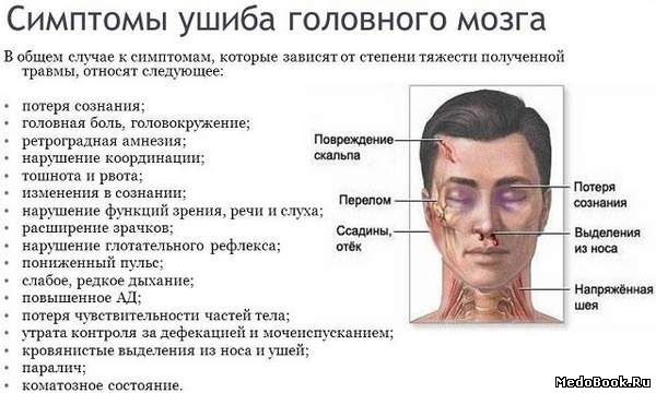 Ушиб мозга: симптомы Ушиб мозга: симптомы